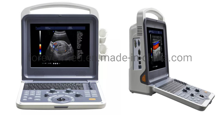 China High Quality Portable Color Doppler Ultrasound Machine