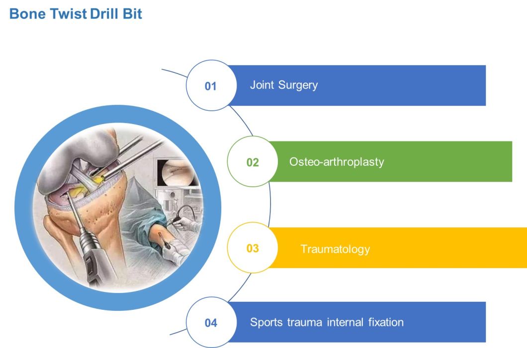 Bone Twist Drill Bit Orthopedic Surgery, Joint, Trauma, Arthroplasty