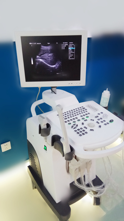 China Ultrasound Scanner Manufacturer Trolley