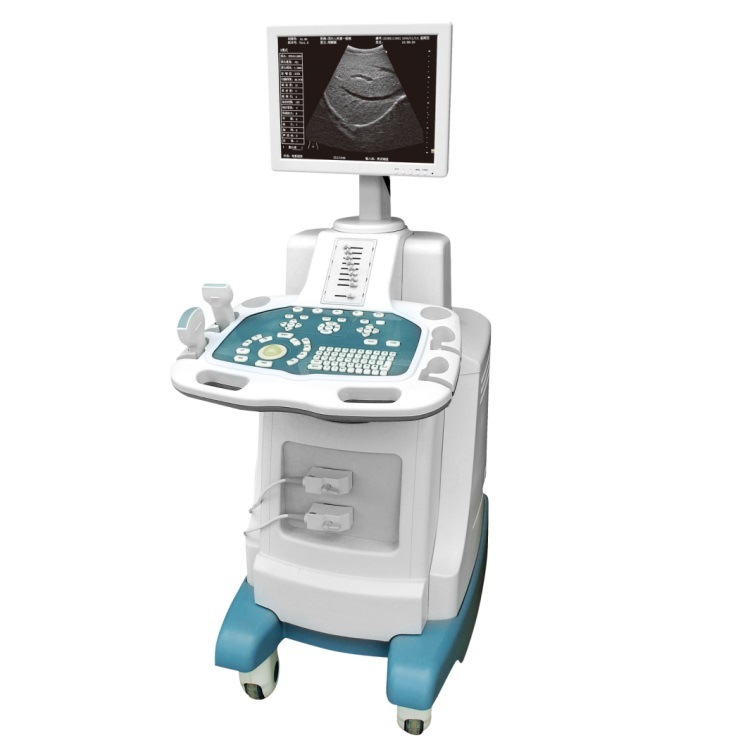 Hot Selling Laptop Ultrasound Scanner Ultrasound Bone Densitometer