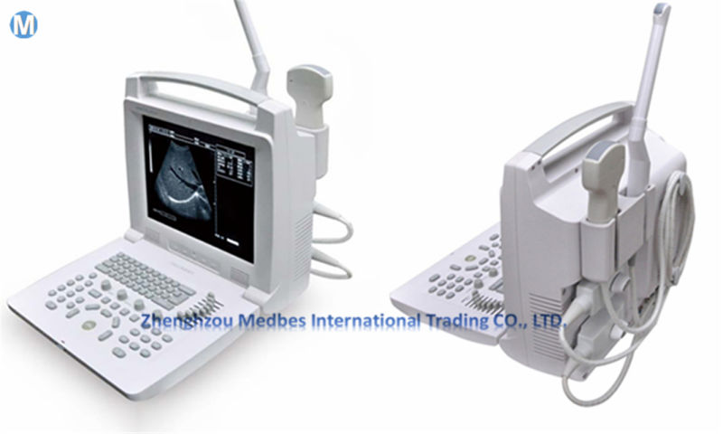 B-Ultrasound Diagnostic System 3D B W Cheapest Ultrasound