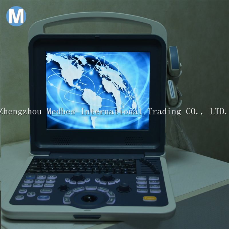 Vascular Laptop Portable Color Doppler Ultrasound