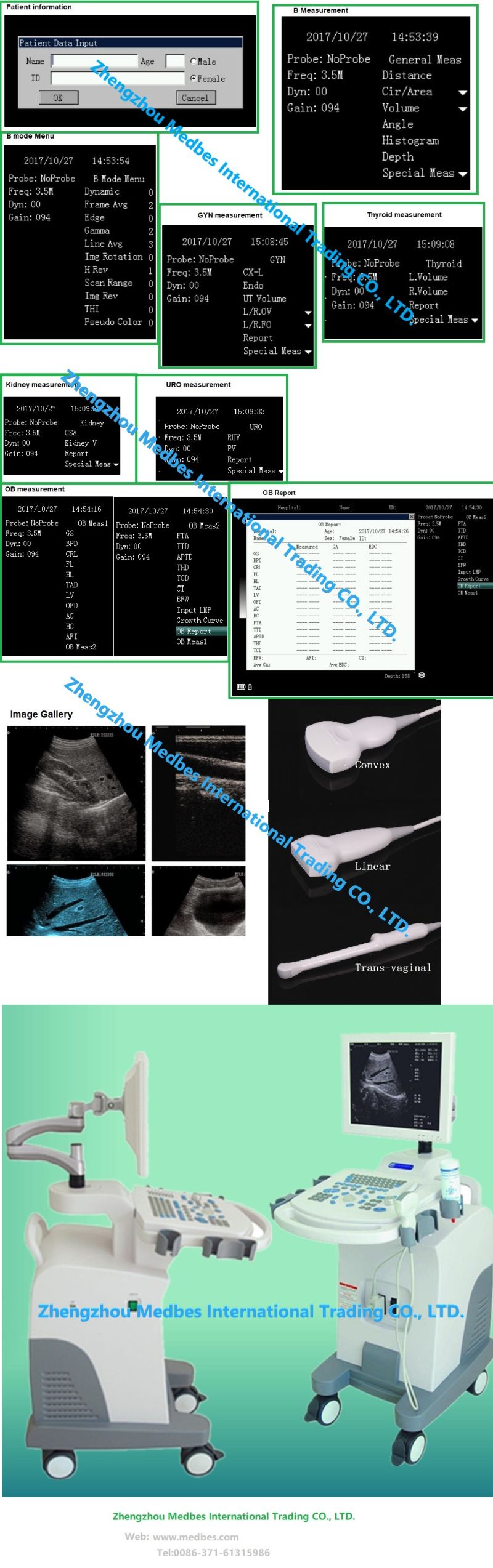 China Ultrasound Scanner Manufacturer Trolley