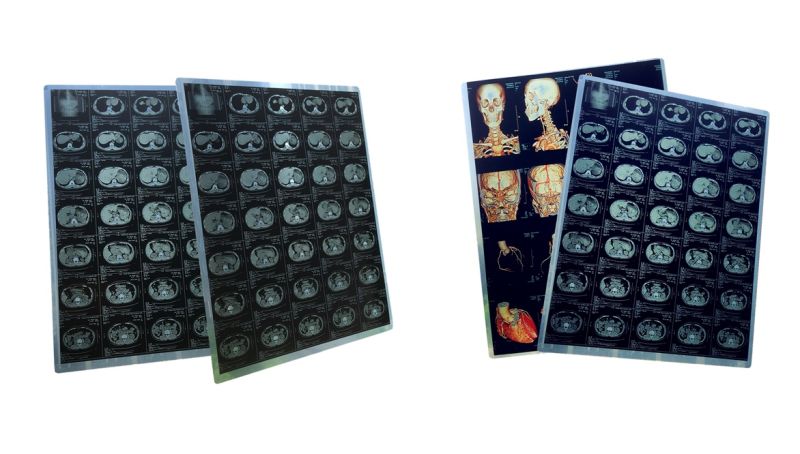 8X10" Hospital Radiology Use Medical Digital Dry Film/Image
