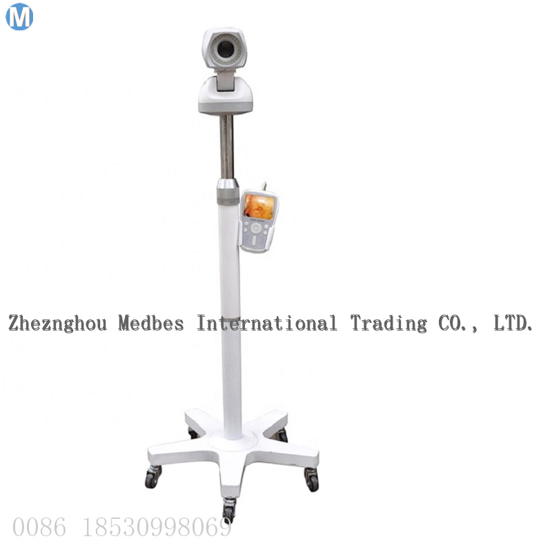 Trolley Digital Electronic Colposcope for Gynecologic Examination Video