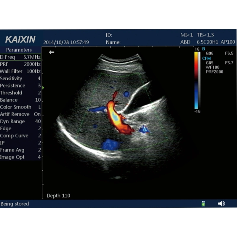 Laptop Color Doppler Ultrasound Measurement Item Under M Mode B/M Mode Ultrasound