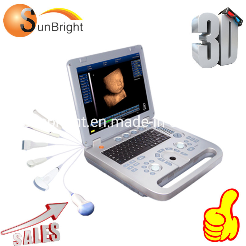 3D Cardiac Portable Ultrasound Scanner 3D Laptop Ultrasound Machine