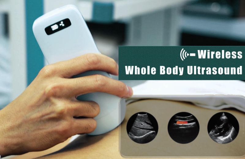 WiFi Wireless Whole Body Ultrasound 3 in 1 (Cardiac / Linear / Convex) Color Doppler Probe
