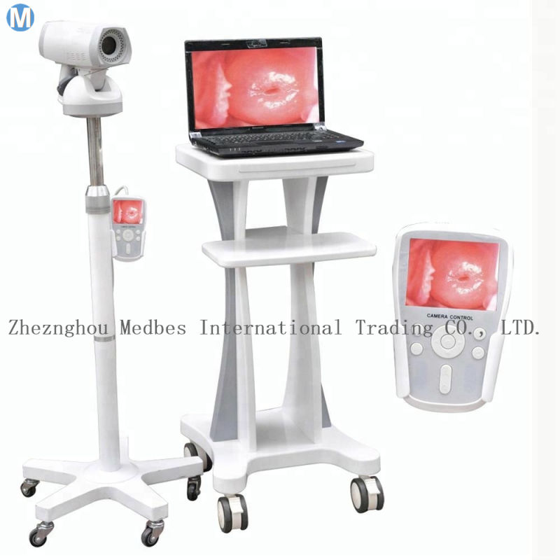 Trolley Digital Electronic Colposcope for Gynecologic Examination Video