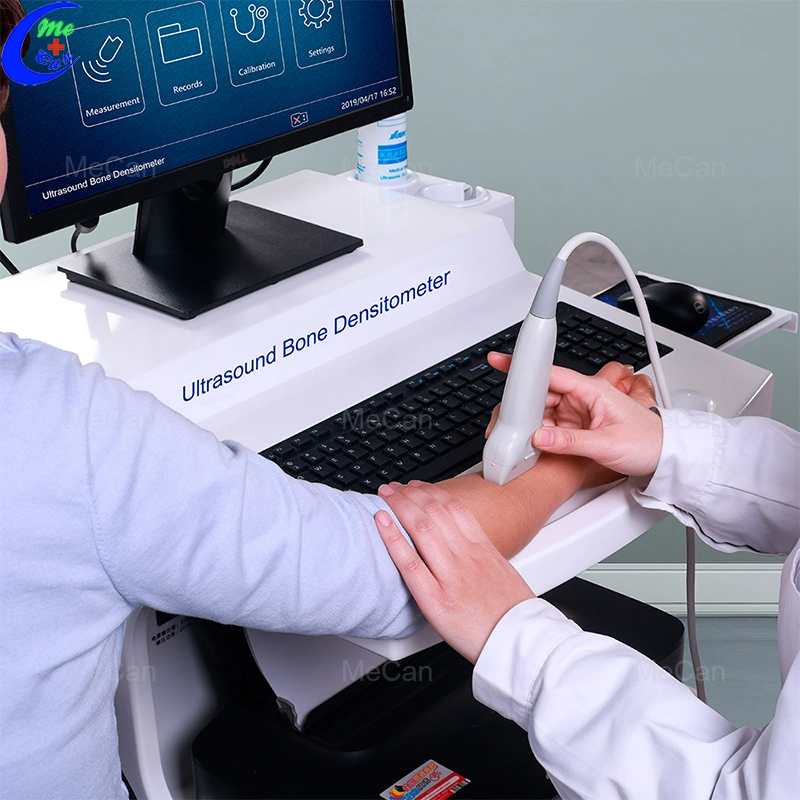 Automatic Portable Trolley Ultrasound Bone Densitometer