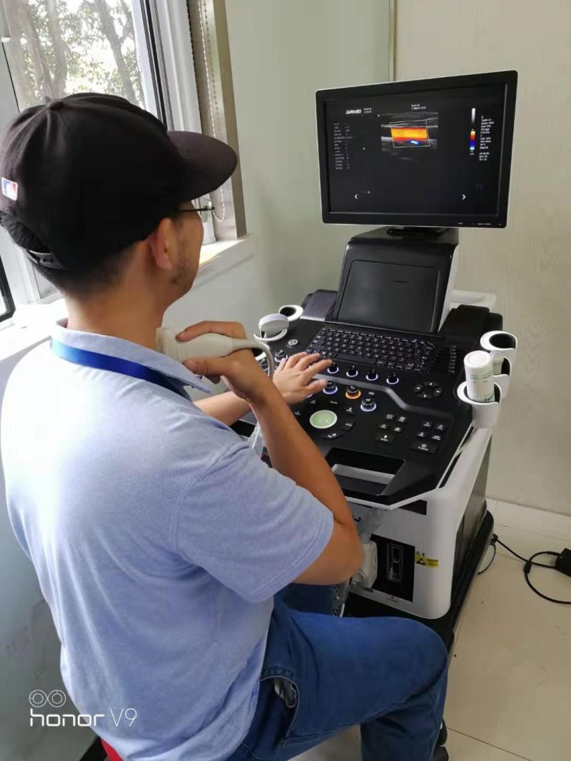Ultrasound Doppler Ultrasound Ultrasound Ultrasound Machine P9 Doppler Trolley Ultrasound