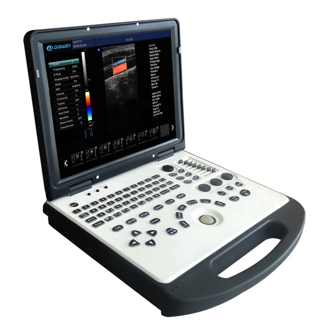 Portable Ultrasound Doppler Ultrasound Ultrasound Laptop Portable Ultrasound Machine Dopple