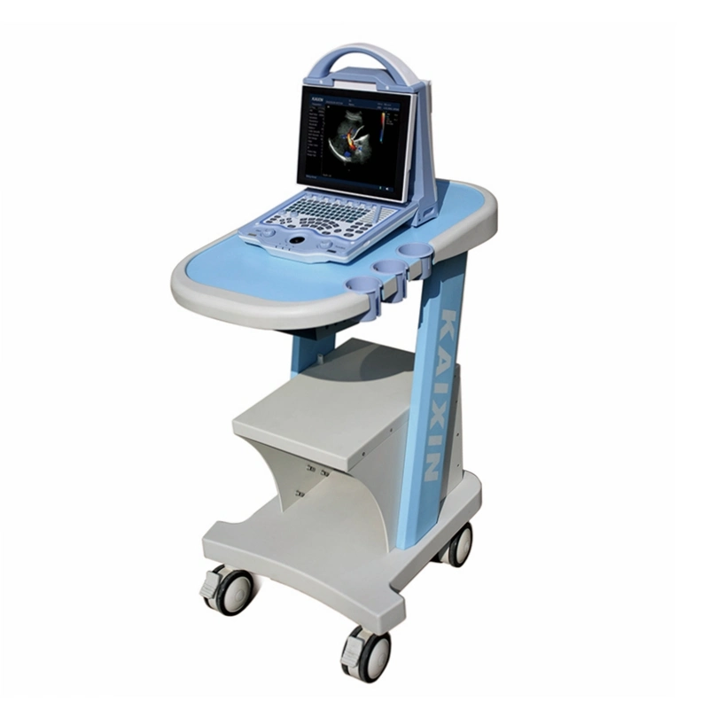 Laptop Color Doppler Ultrasound Measurement Item Under M Mode B/M Mode Ultrasound