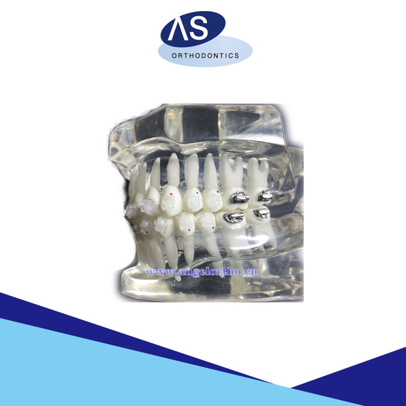 Dental Orthodontic Clear Self Ligating 022 Brackets with 3 Hook/345 Hook