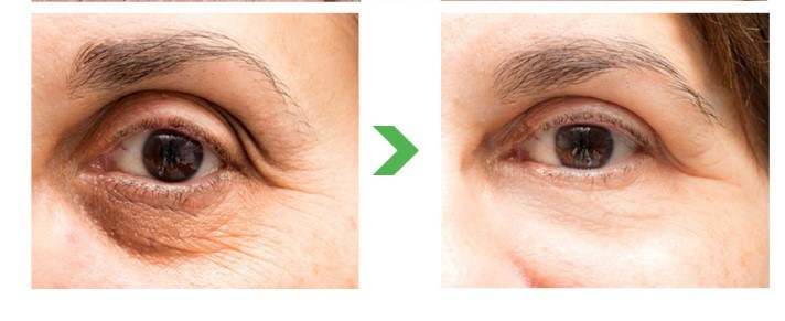 OEM ODM Anti Aging Moisture for Dark Circles Anti Aging Eye Care Serum