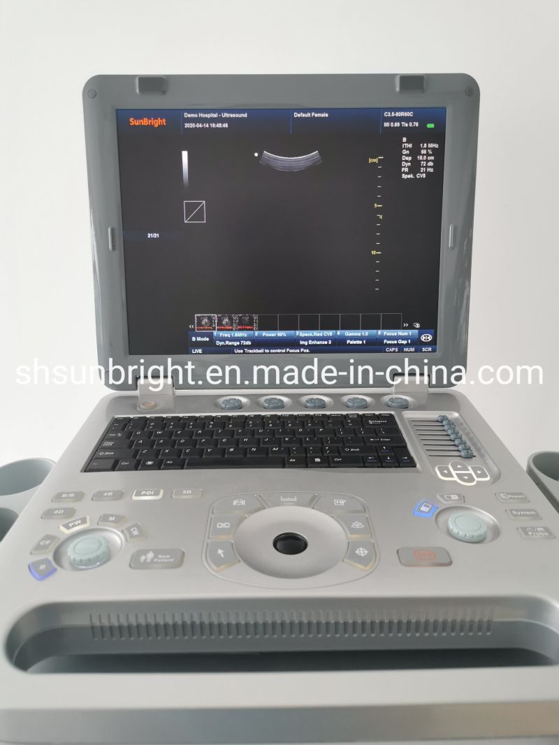 Medical Examination Ob Portable Scan 4D Ultrasound Machine Price Color Doppler