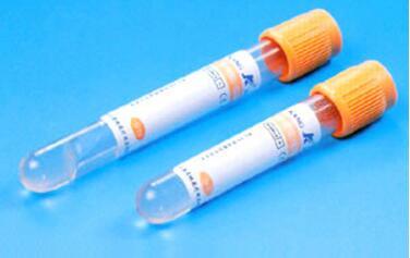 Non-Vacuum/ Vacuum Blood Collection Tube, Glass/ Plastic with Ce, ISO13485