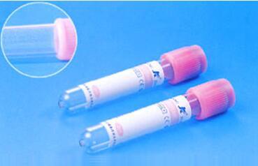 Non-Vacuum/ Vacuum Blood Collection Tube, Glass/ Plastic with Ce, ISO13485
