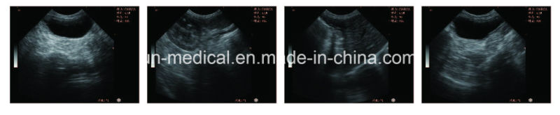 Medical Portable Full-Digital Trolley Pregnancy Medical Fetal Diagnostic Ultrasound Scanner