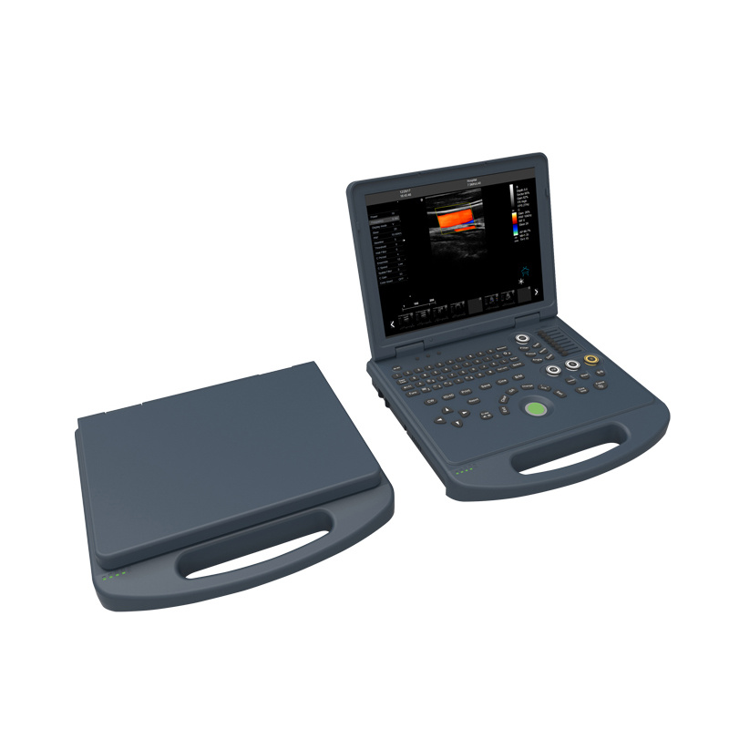 4D Hand-Carried Color Doppler System Portable Ultrasound Scanner
