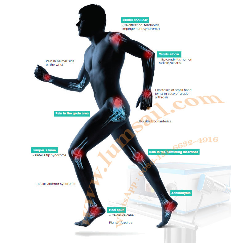 Swt pneumatic Shockwave Machine Vertical Shockwave Therapy Equipment