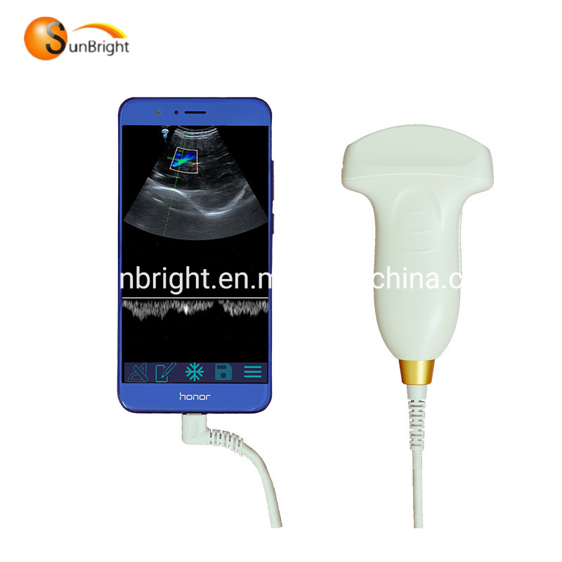 Color Doppler Wireless Convex Probe Pocket Mini USB Ultrasound Probe