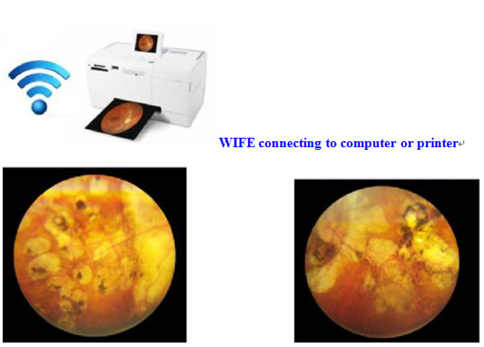 Handheld Digital Portable Eye Exam Fundus Camera, Ophthalmic Fundus Camera