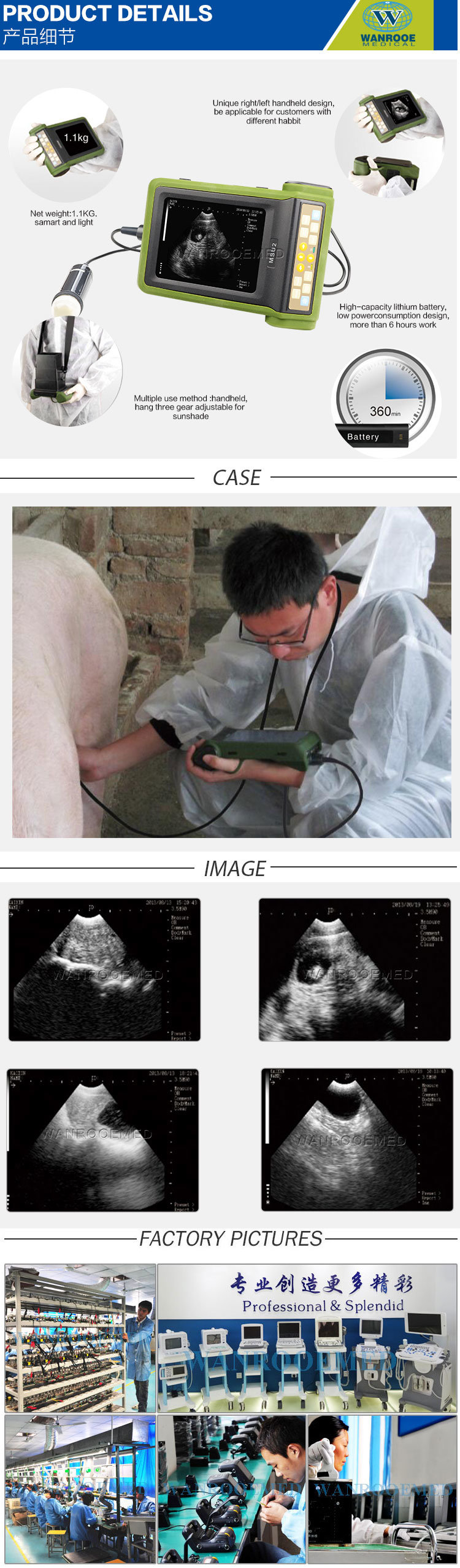 Usmsu2 Medical Portable Veterinary Ultrasound Detector Scanner for Ovine Swine