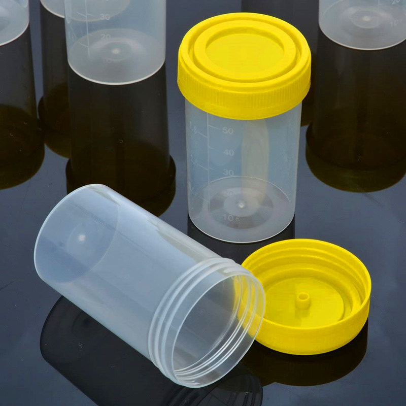 Disposable Medical Specimen 30ml Container Urine Cup with Factory Price
