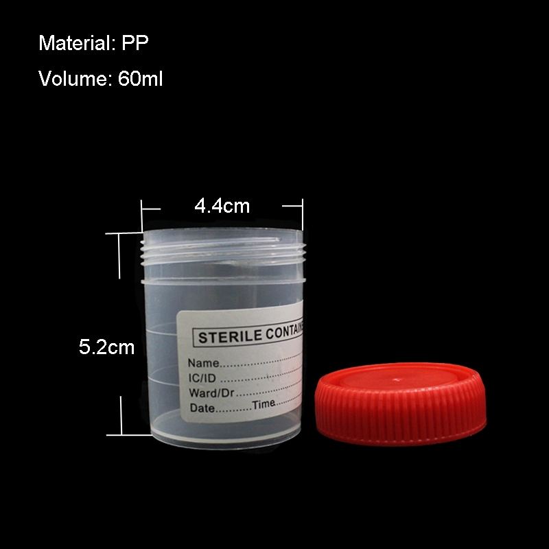 New Product Specimen Vacuum Medical Sterile Urine 60ml Container Cup