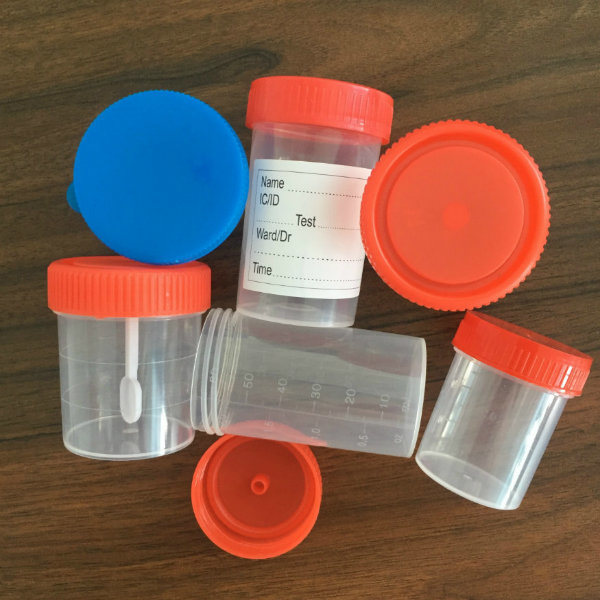 Medical Use Sterile Urine and Stool Sample Container 40ml 60ml 120ml