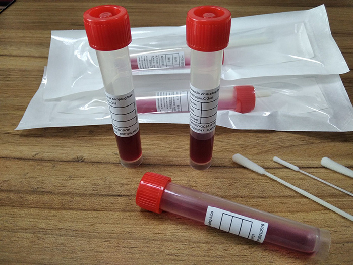 Saliva Virus Utm Vtm Sample Collection Kits with Nasal Oral Swab