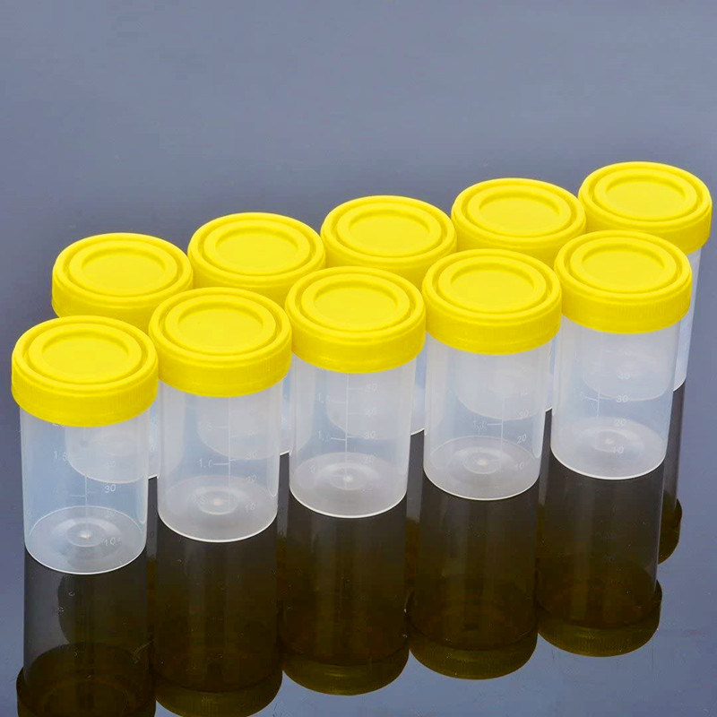 Disposable Medical Specimen 30ml Container Urine Cup with Factory Price