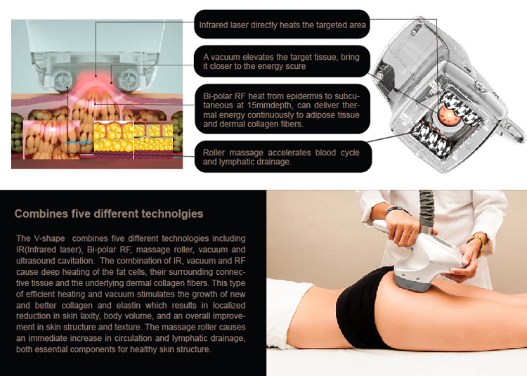 Smoother Parts Optimal Body Contouring Device Velashape V9 Machine Pricefor Weight Loss
