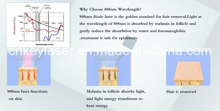 Diode Laser Hair Removal Better Cooling System