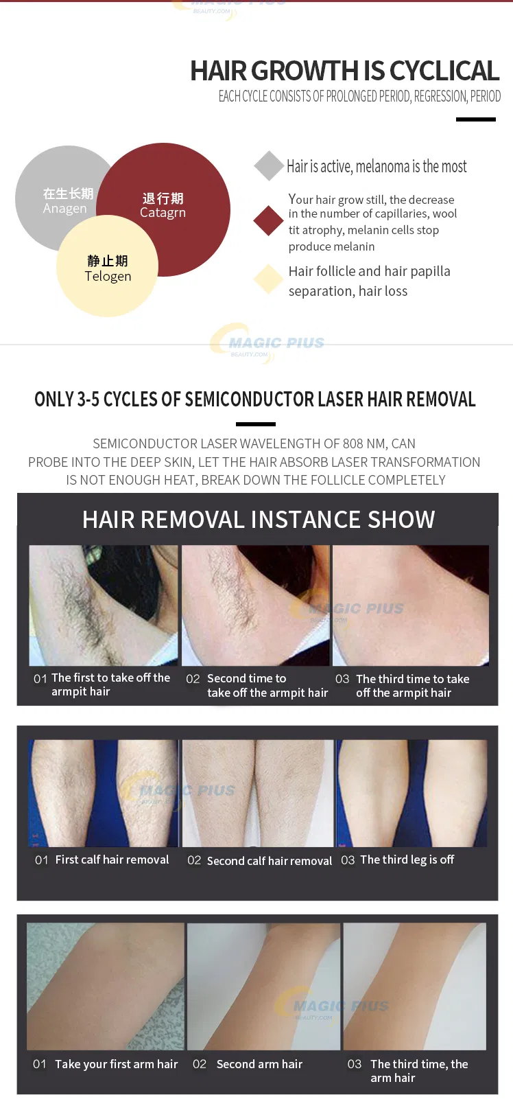 Permanent 808nm Diode Laser Fast Hair Removal Depilation Laser Machine