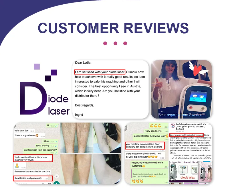 1064 Diode Laser Diode Laser for Hair Removal Diode Laser Hair Removal