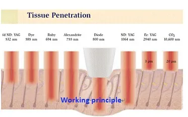 Whole Sale Taiwan Tech Triple-Wave Diode Laser Factory Directly Offer