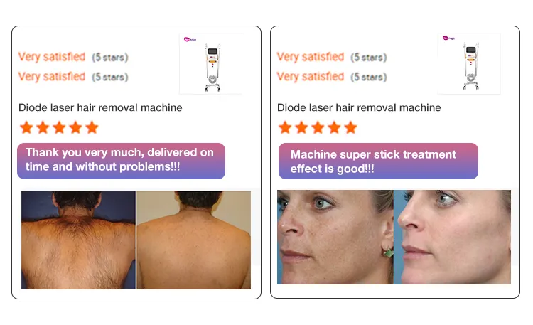 Laser Hair Removal Device Professional Clinic Accurate Laser Hair Removal Patented Technology 3 Wavelengths