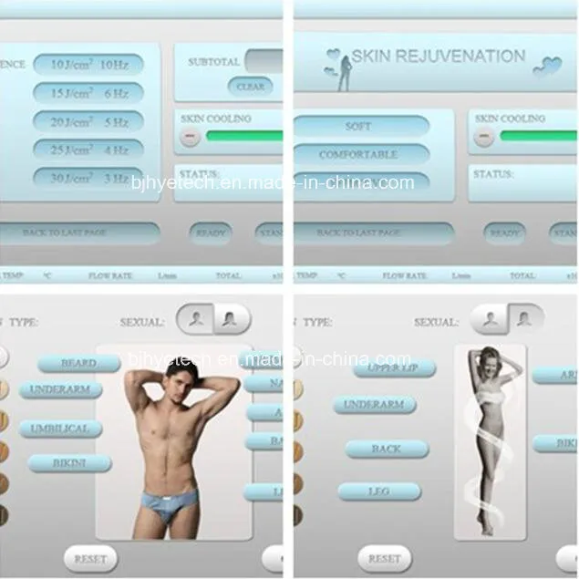 Depilation Laser Diode 808nm /Diode Laser Hair Removal