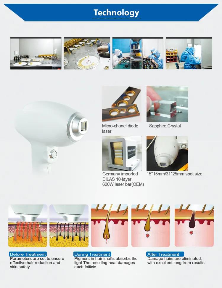 Laser Diode 808nm / 808 Diode Laser Hair Removal Machine / Diode Laser 808nm Hair Removal