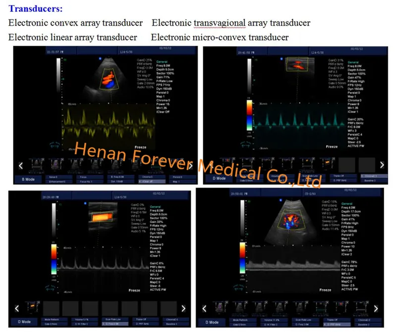 Excellent Quality Medical Equipment Full Digital Ultrasound Diagnostic System