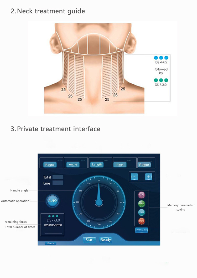 New Technology Anti-Wrinkle Vaginal Tightening Hifu Face Vaginal Machine