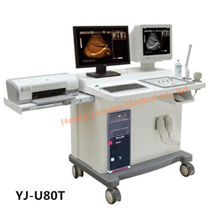 Yj-U60t Newest China Products Suppliers Ultrasound Diagnostic Scanner