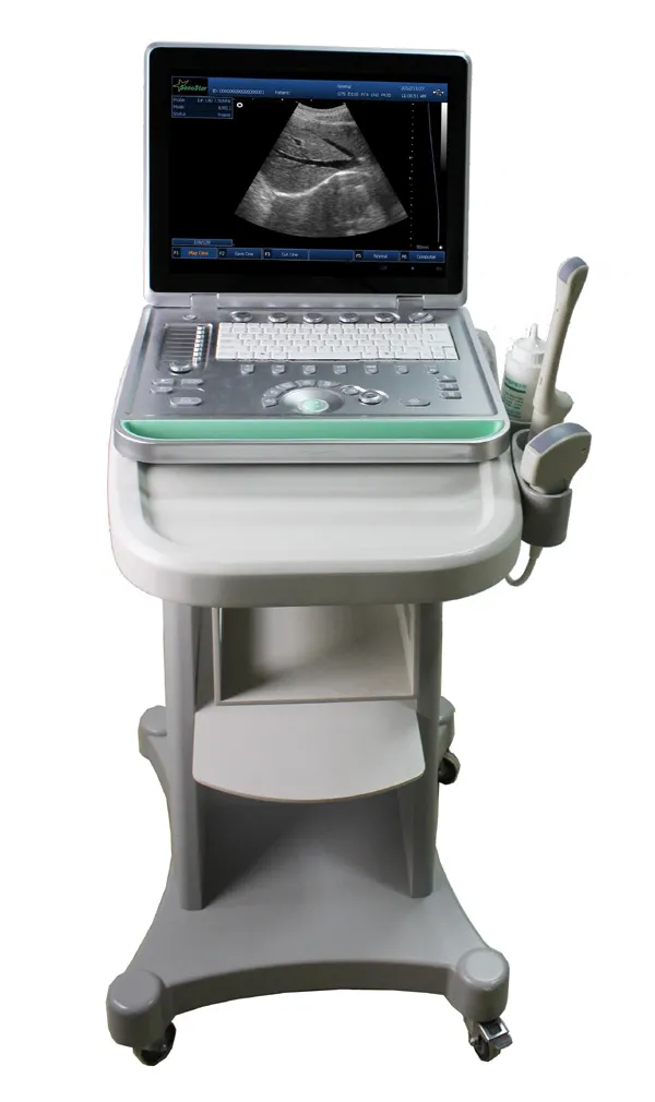 Medical Cheap PC Based B Mode Laptop Ultrasound for Pregnant