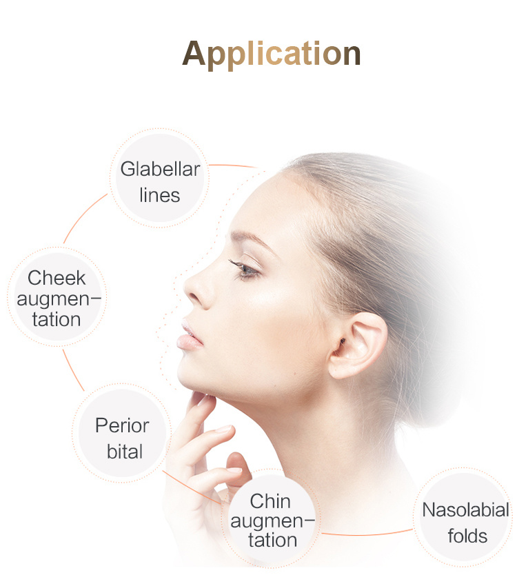 Hyaluronic Acid Cross Linked/Korea Hyaluronic Acid Filler/Hyaluronic Acid Syringe