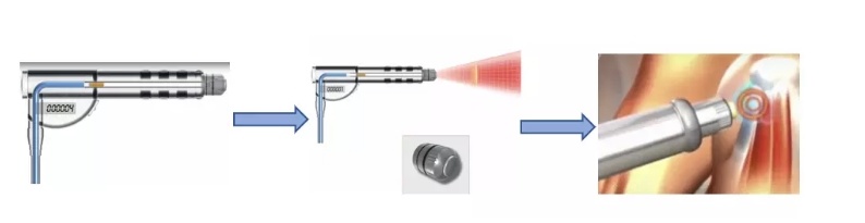 Shockwave Apparatus Shockwave Physiotherapy Instrument Eswt Focal