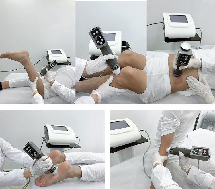 Mini Shockwave Physiotherapy Machine / Radial Shockwave Therapy for Fat Reduce