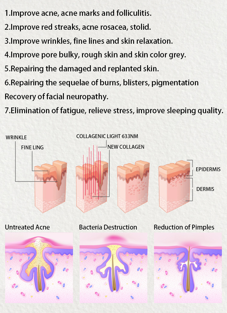 Photodynamic Therapy / Red Light Therapy / LED Light Therapy LED PDT