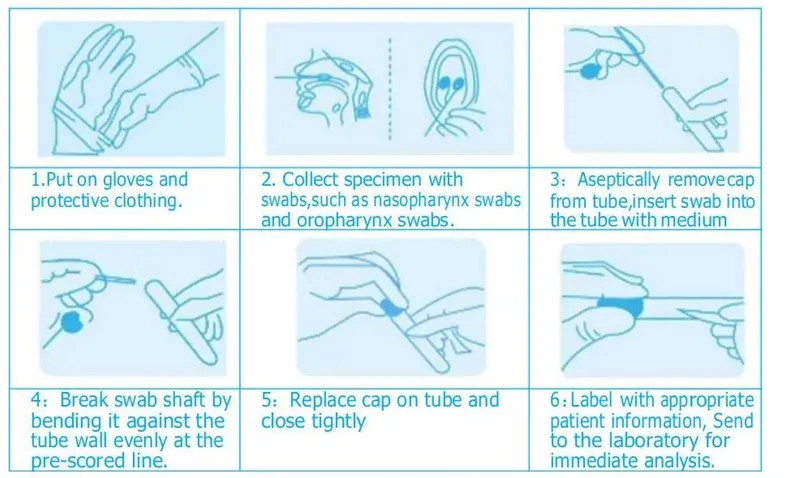 Transparent PP Tube with Swab Kit for Sampling Patients and Non-Patients